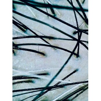 健康的な頭皮の色は何色？_20251204_1